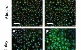 Показана возможность управления скоростью биодеградации наночастиц пористого кремния в живых клетках.