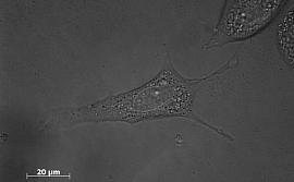 3. Обычные фибробласты мыши, снятые сканирующим электронным микроскопом