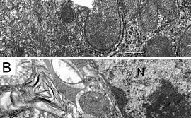 Рис. 2. Микрофотография митохондрий печени крысы при гипертиреозе. Ламеллярные структуры показаны стрелками. Шкала 0,5 µm