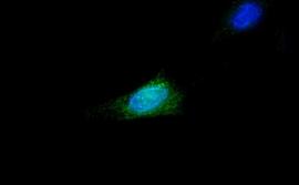 2. Первичные фибробласты мыши, куда ввели наночастицы. Они светятся зеленым цветом в цитоплазме вокруг ядра.