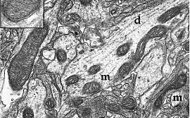 Электронная микрофотография митохондрий коры головного мозга крысы.