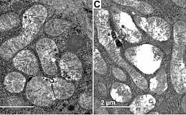 Ультраструктура митохондрий печени крысы в контроле (A) и при экспериментальном гипертиреозе (B-D). *, мультиламеллярные тельца. ﻿