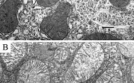 Рис. 1. Микрофотография участков гепатоцита крысы в контроле (А) и при гипертиреозе (В). Шкала 0,5 µm