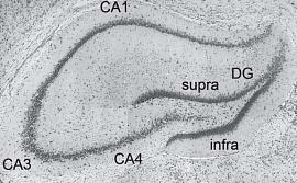 Микрофотография сечения гиппокампа мозга крысы. 