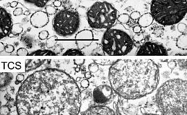 Фотографии митохондрий клеток печени крыс до обработки триклозаном и после (нижний снимок), сделанные под электронным микроскопом. На нижнем снимке показано набухание митохондрий в результате повреждения мембраны триклозаном.